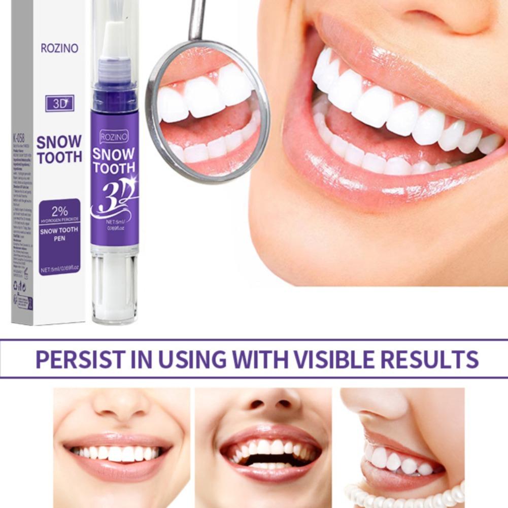 3D długopis do wybielania zębó – Teeth Whitening Near Me recenzja i cena